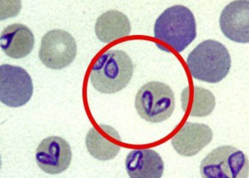 Babesia caballi